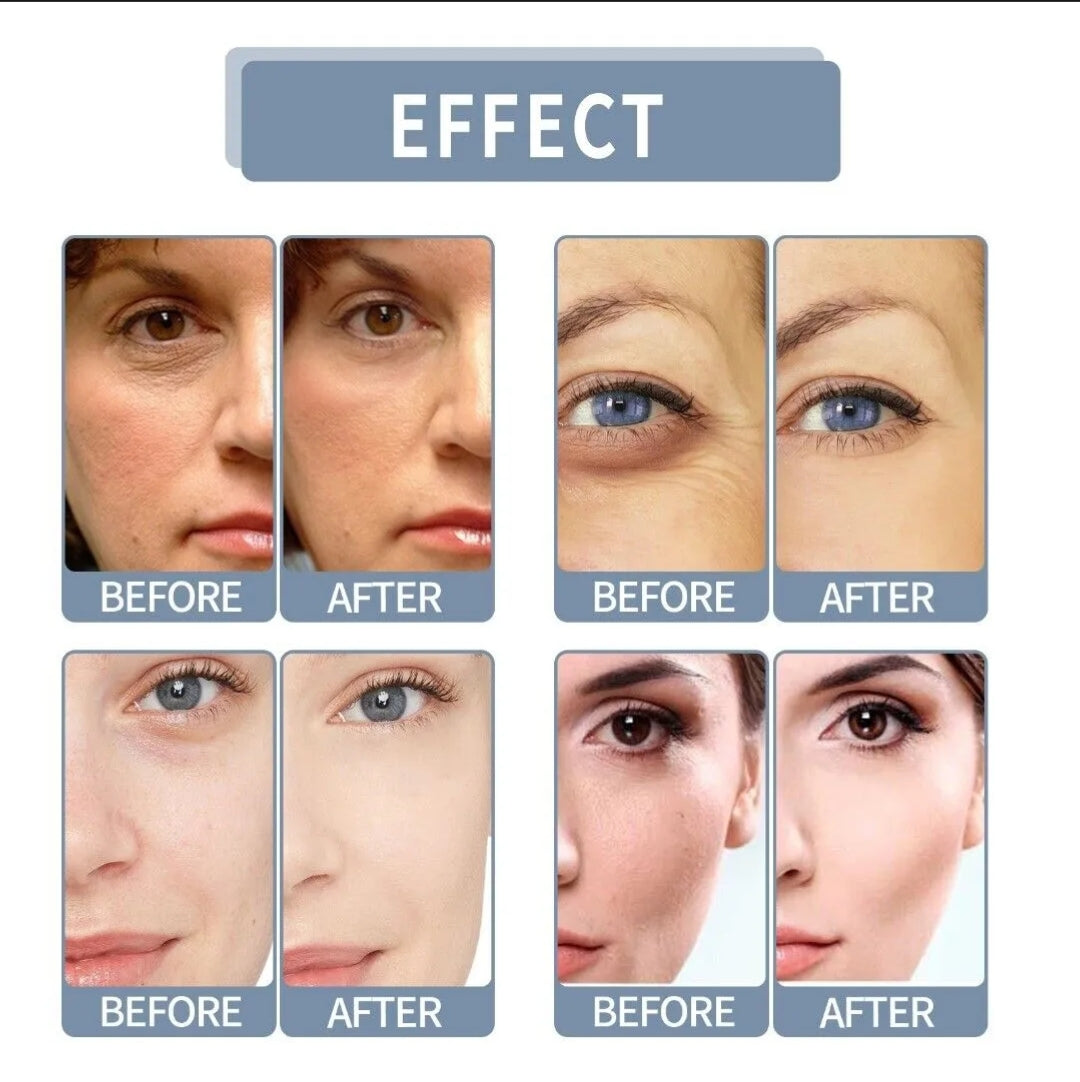 ⭐ Product Highlights

10% Vitamin C for bright and glowing skin

Helps remove pigmentation and dark spots

Reduces signs of aging

Protects skin against sun damage

Contains 2% Hyaluronic Acid for deep hydration

Lightweight, fast-absorbing formula

Suita